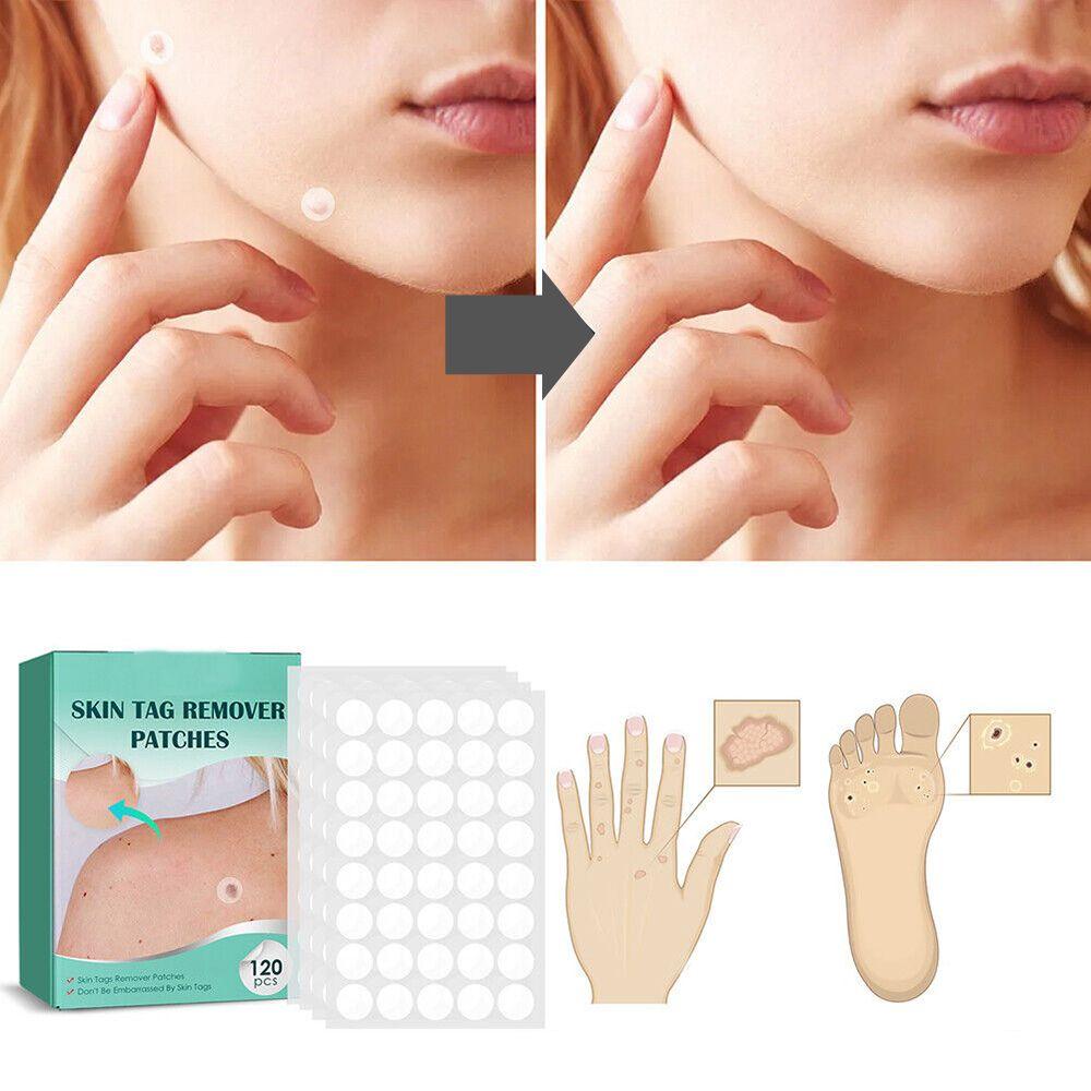 Patches pour élimination des taches cutanées et verrues avec hydrocolloïde – Indolore et discret – 120 pièces | Sulvida