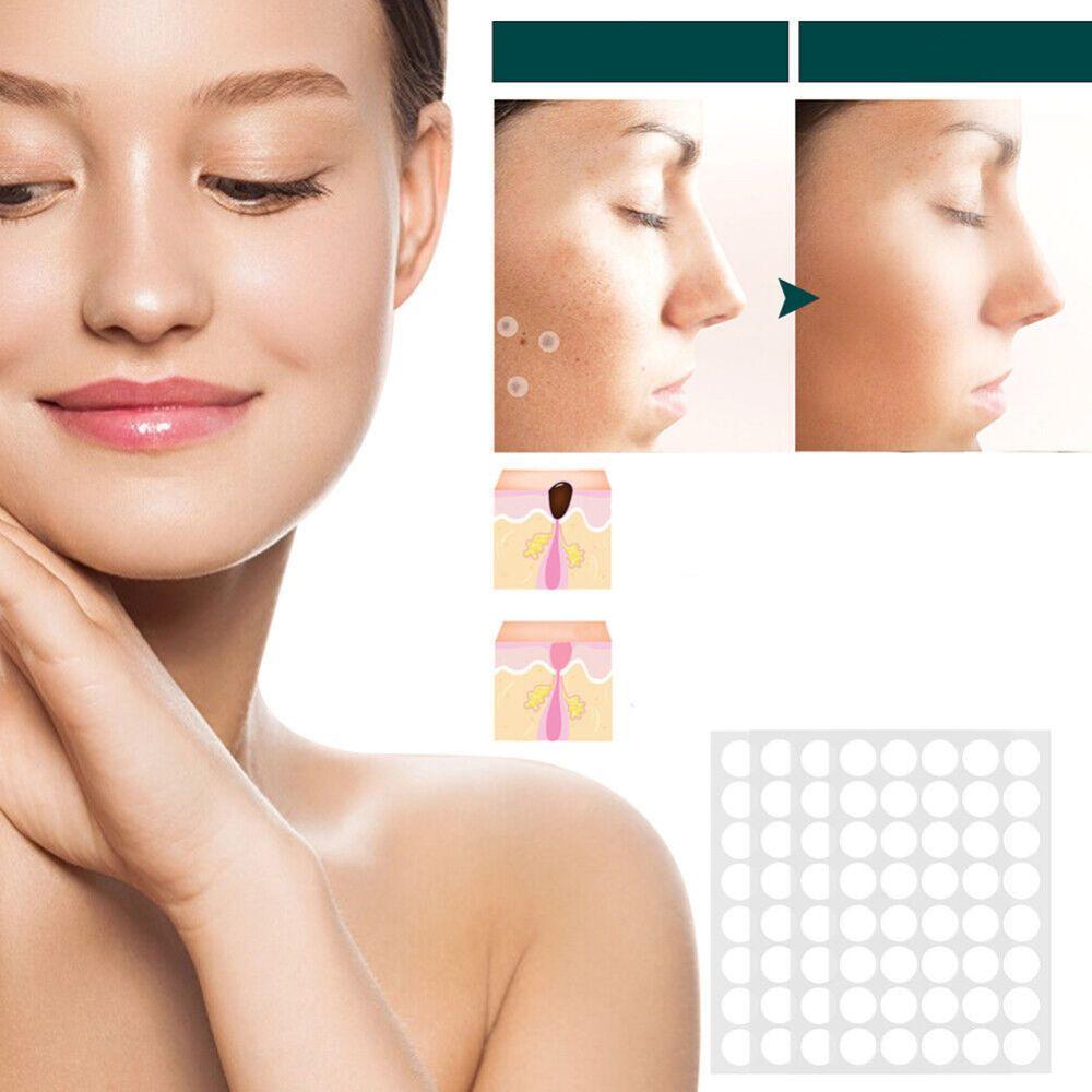 Patches pour élimination des taches cutanées et verrues avec hydrocolloïde – Indolore et discret – 120 pièces | Sulvida