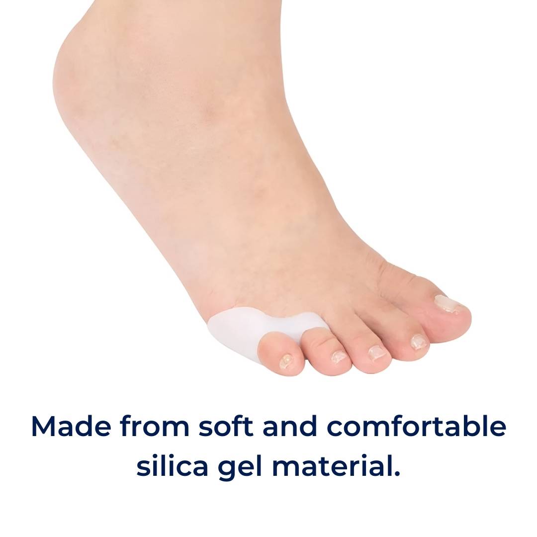 Orthopedische Teenspreiders voor Bunionette Correctie – Hallux Valgus Uitlijning – Little Toe Straightener – Hamertenen Preventie – Dagelijks Draagcomfort | Sulvida