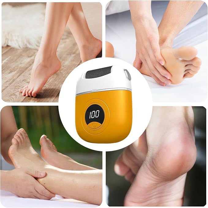 Éliminateur Électrique de Callosités avec Rouleau pour Pieds Doux – Pédicure à Domicile | Sulvida