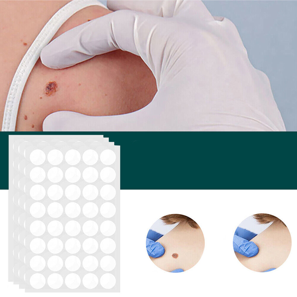 Patches pour élimination des taches cutanées et verrues avec hydrocolloïde – Indolore et discret – 120 pièces | Sulvida