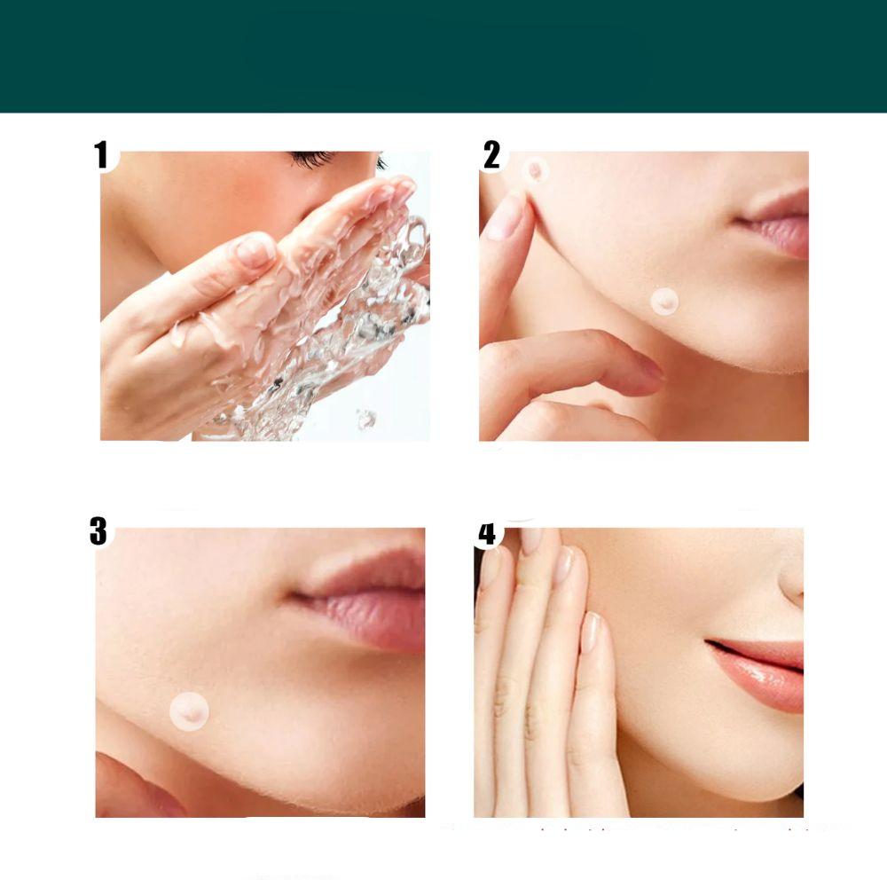 Patches pour élimination des taches cutanées et verrues avec hydrocolloïde – Indolore et discret – 120 pièces | Sulvida